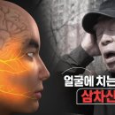 [994회] 생로병사의 비밀/[얼굴에 치는 벼락,삼차신경통]세수만 해도,바람만 스쳐도 얼굴에 벼락이 내리치는 듯한 통증이 찾아온다... 이미지