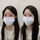 눈썹공간 이미지