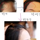 달헤어 이미지