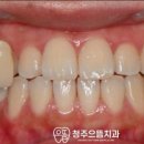 청주으뜸치과의원 이미지