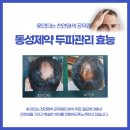 두피케어머리염색방 이미지