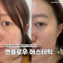 그랜드프라자 | 상동 윤곽관리 데콜테 맛집 연플로우 에스테틱 예신관리 후기