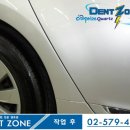 덴트존 - 안양시 만안구 오리로34번길 25-10 | 덴트존