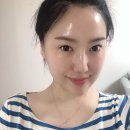 이노필 | 대전 둔산동 리프팅 실리프팅 리얼후기