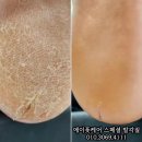 발건강관리사(2급) 이미지