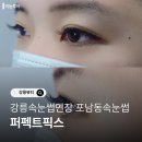 퍼펙트 | 강릉속눈썹연장 포남동속눈썹 [퍼펙트픽스] 후기