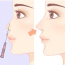선후솔루션 이미지