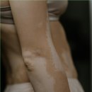 센텀모빅스피부과의원 이미지