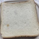 치질 수술 8일째