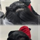 죽봉대로L | 광주탈모, 두상 맞춤 디자인이 주는 안도감! 스칼프나잇 후기