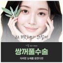 정웅기성형외과의원 | 장원영 쌍수 고등학생 자려 눈매 쌍꺼풀수술 후기 정웅기성형외과