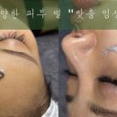 예린 더 스킨