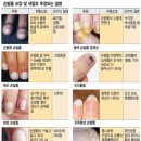 하얀손톱