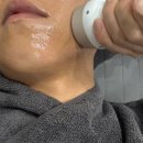 웨이브필 | 향남피부과 맥스웨이브 후기