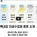 경기성모안과 백내장 렌즈 종류별 선택법 안내