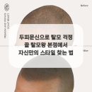 탈모왕 본점 이미지