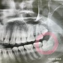 찬스플란트치과의원 이미지