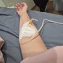 예젤유의원 맘모톰 수술비용 및 이원경원장님 후기