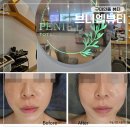 브니엘 | 구미 인동 피부관리 브니엘뷰티 | 플라셀맥스 리프팅 효과 후기