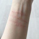 심바동물병원 | 아비시니안 심바의 ‘호산구성육아종’ 치료 일기(1)