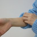 장미반점 이미지