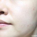 아임케어 이미지