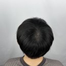 신림두피 아크로매틱에서 꼼꼼하게 케어 받은 후기
