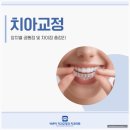 미소자인교정치과의원 | 첨단 치과에서 알려드리는 치아교정 장치 종류와 선택 방법, 나에게 맞는 교정이 따로 있습니다