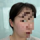 구로리프팅 써드힐 헤어스파 소노온리프팅 구로디지털 피부관리 추천