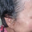 두드림 보청기 | /두드림보청기/ 대구보청기 시그니아 귓속형보청기로 구매했어요