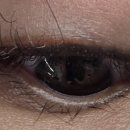 컴포트성형외과의원 이미지