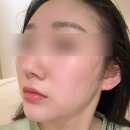 구미 에스테틱 건조피부 수분관리 오에이에스테틱 송정