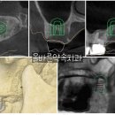 보강치과기공소 이미지