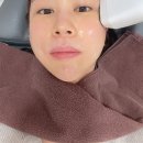 소프웨이브 리프팅 N번째 받은 내돈내산 후기! 효과, 통증, 유지기간, 가격