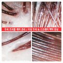 더위에 지친 두피 스케일링 ☆ 옵시디앙 올젠 시그니처 ☆ 두피 트러블 케어 ☆ 두피 고민 CUT!