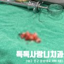 대구 톡톡사랑니치과 매복 사랑니 발치 후기 / 대구 사랑니 치과 추천
