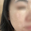 비비소프트 | 여드름비비추천 셀퓨전씨 워터핏 리커버 비비(내추럴라이트vs소프트베이지