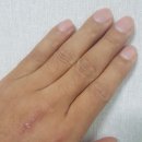 발렌스의원 이미지