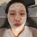 모자한의원 | 불당 천안피부전문한의원에서 새살침 2회차 + 새살약침 내돈내산 회복후기 (혐 주의)