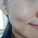 아리유 | 아리유 레이저닉 마스크팩으로 피부미인 도전!