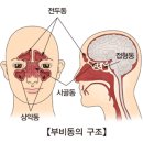 부비동염[Sinusitis]귀코목질환 이미지