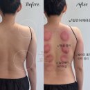 부산 서면 마사지샵 &#39;우아로움&#39;슬리밍 관리 후기