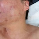 더뷰에스테틱 | 울산 피부관리 더뷰에스테틱 울산남구점 다녀온 솔직후기