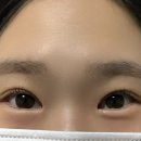 유디온(udion)