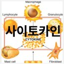 박은희