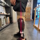 의족보조기센터 이미지