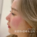 청량리12 | 포텐자 쥬베룩 후기 어느덧 청량리 피부과 12