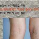 바른정백외과의원 네이버블로그