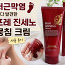 진세노 | 족저근막염 검색하다 발견한 리포레 진세노 발뭉침 크림 사용 후기