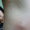 예항맥외과 이미지